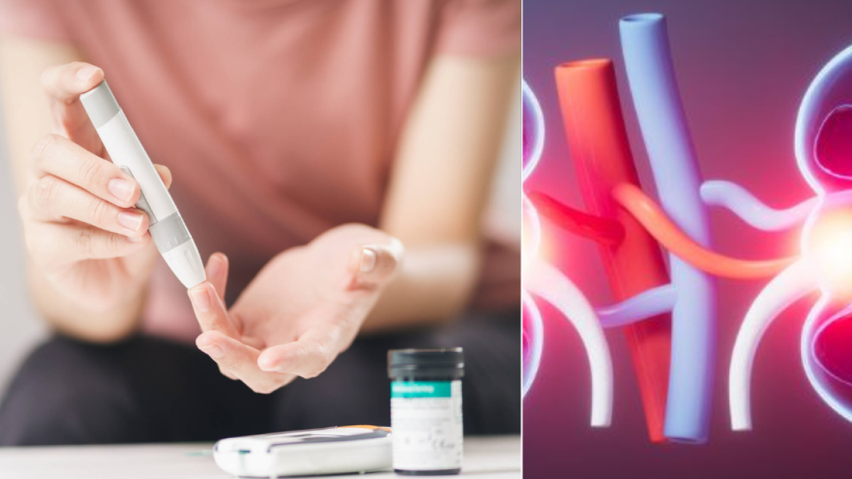 ¿Qué efecto tiene en los riñones la diabetes? 6 síntomas de un daño irreversible