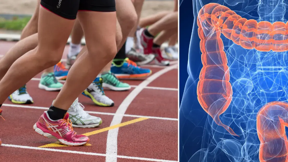 ¿Los maratones y las carreras extremas pueden estar relacionados con el cáncer de colon? Estudio relaciona efectos en menores de 40 años