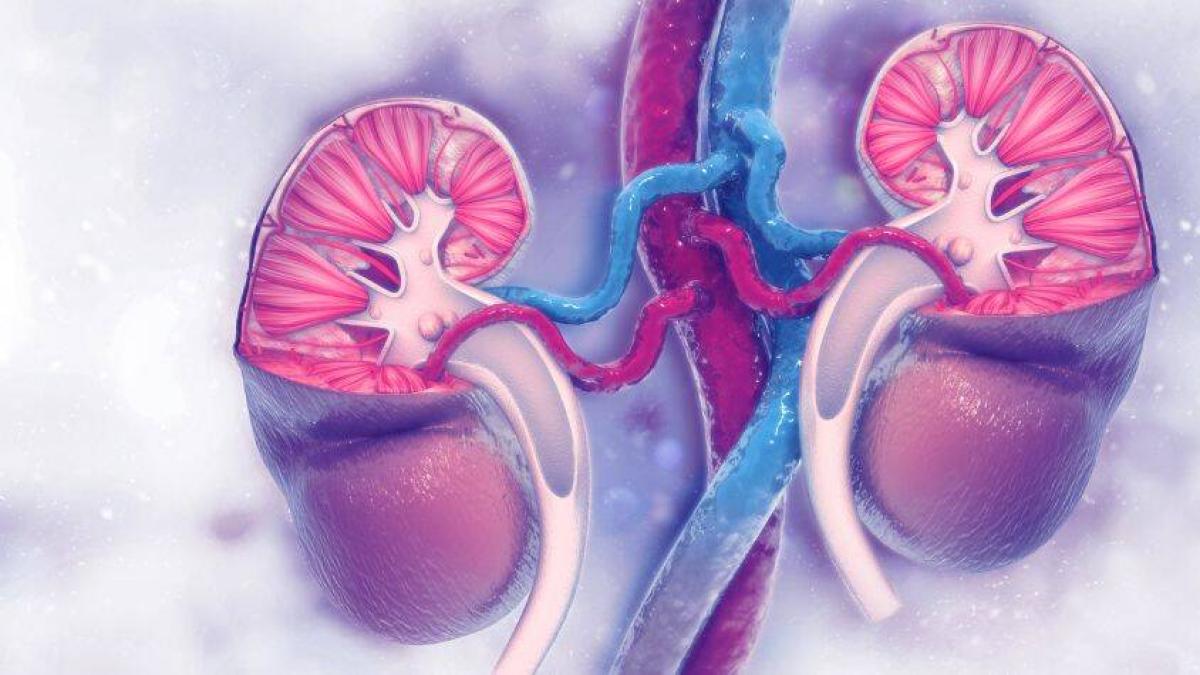 Si consume esta vitamina, puede sufrir cálculos en los riñones: la clave para evitarlo