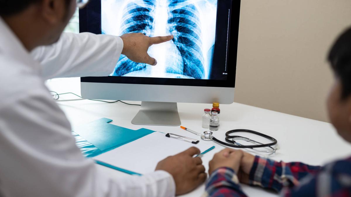 Tuberculosis en Bogotá: este año se han diagnosticado 546 casos ¿Por qué los hombres son los más afectados y aumenta el registro?