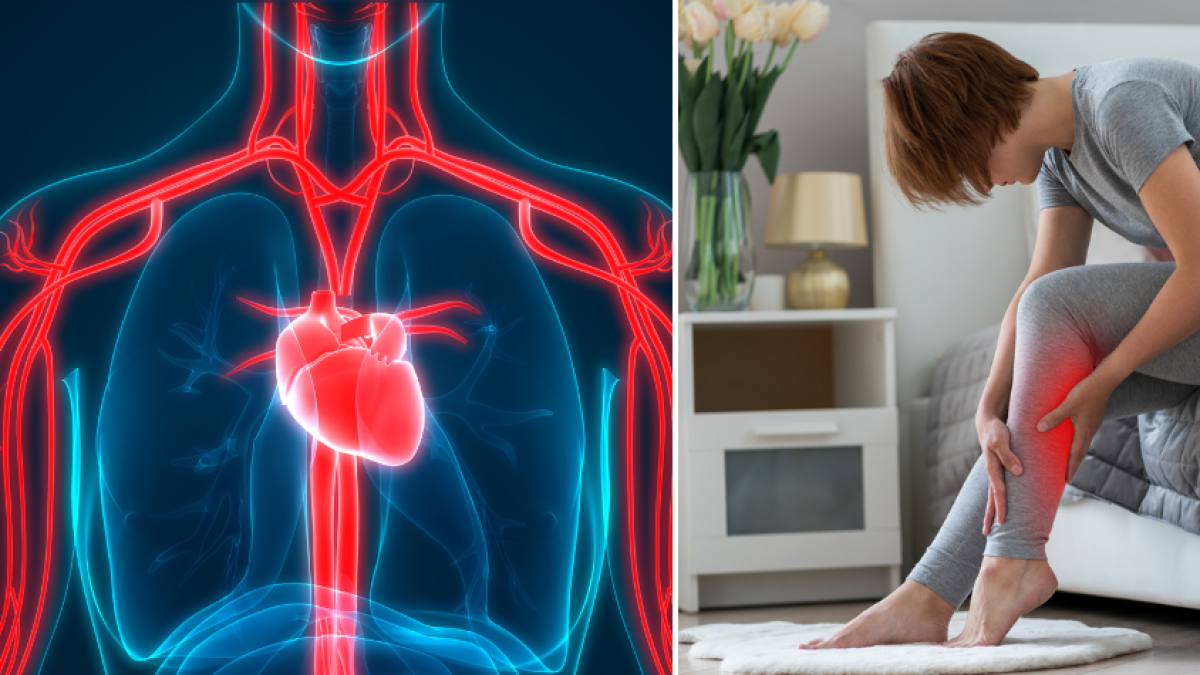 Tiene Mala Circulación Conozca La Solución Y Posibles Causas