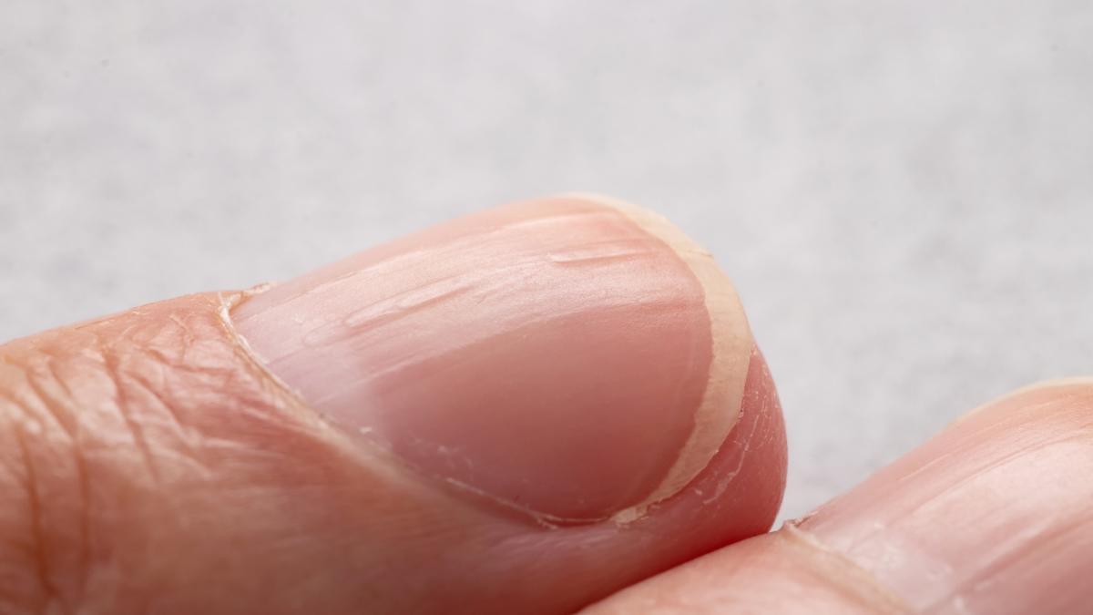 La señal de sus uñas que nunca debe ignorar por salud: experta de EE. UU.
