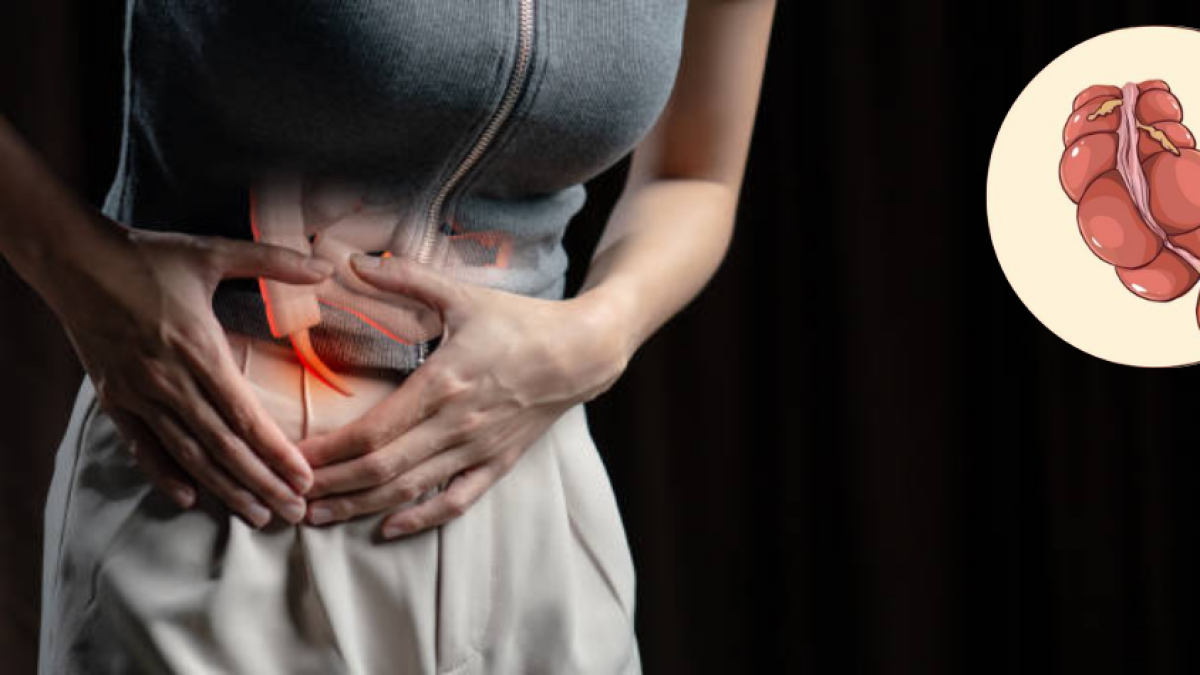 Alerta Joven: Aumento del Cáncer de Apéndice y Señales de Alerta Clave