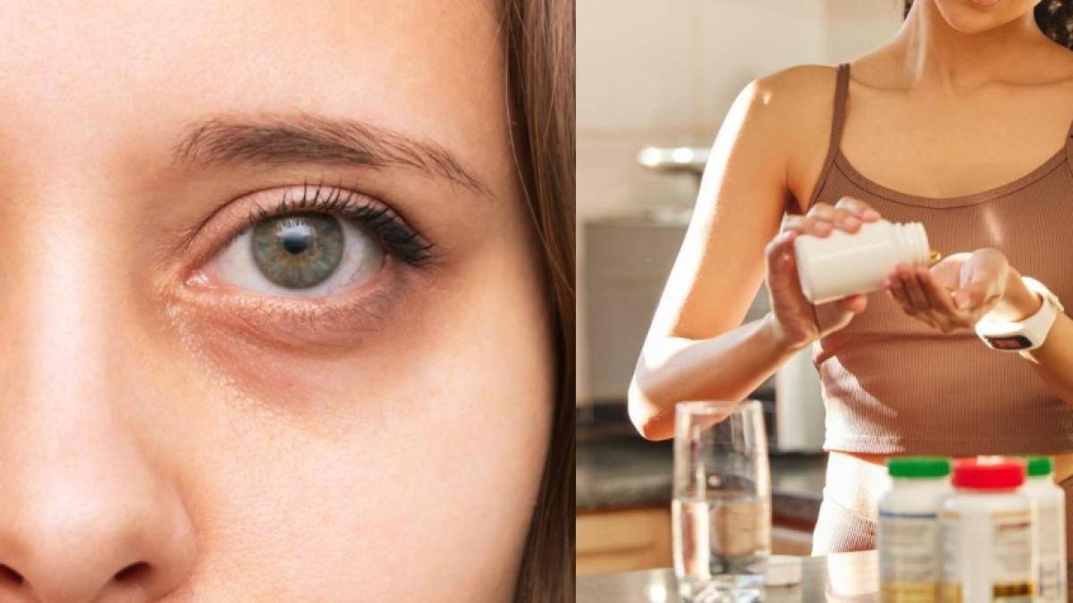 Descubren la falta de una vitamina como causante de las ojeras: hay una fruta que ayuda a mejorarla