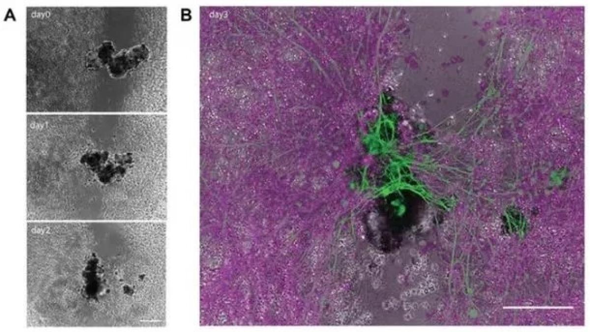 Científicos descubrieron que las células siguen vivas y crean nuevos organismos después de que una persona muere