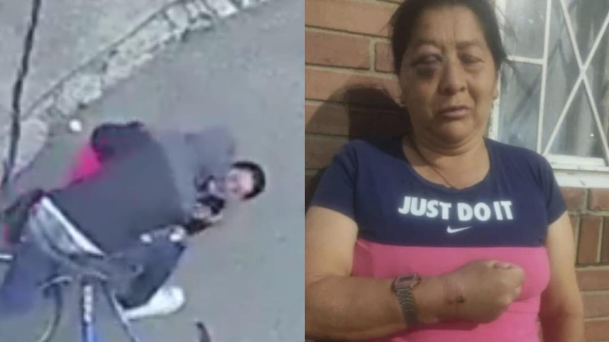 A mordiscos, hombre robó a una mujer de 50 años y la dejó gravemente herida en el sur de Bogotá