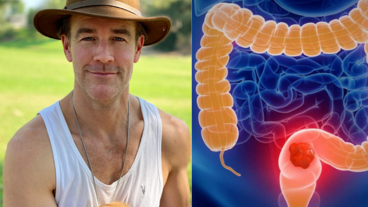 James Van Der Beek, protagonista de ‘Dawson's Creek’, revela que padece cáncer de colon: estos son los síntomas de alerta