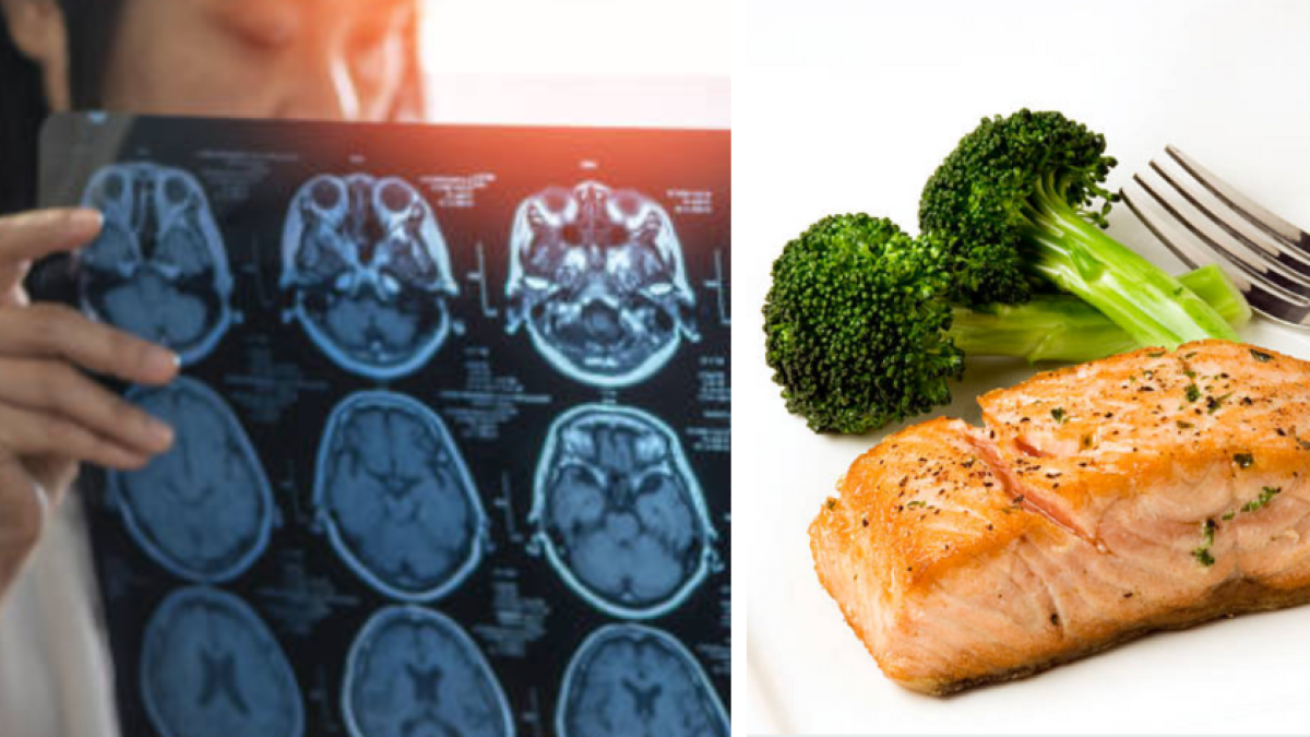 Neurocirujano revela la cena ideal para prevenir el Alzheimer: 'Es fácil de preparar y no requiere de muchos ingredientes'