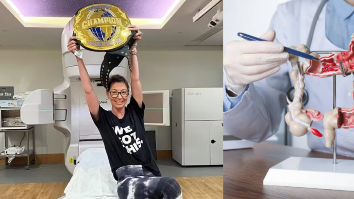 Mujer de 34 años fue diagnosticada con cáncer de colon en etapa 3: los síntomas que los doctores ignoraron