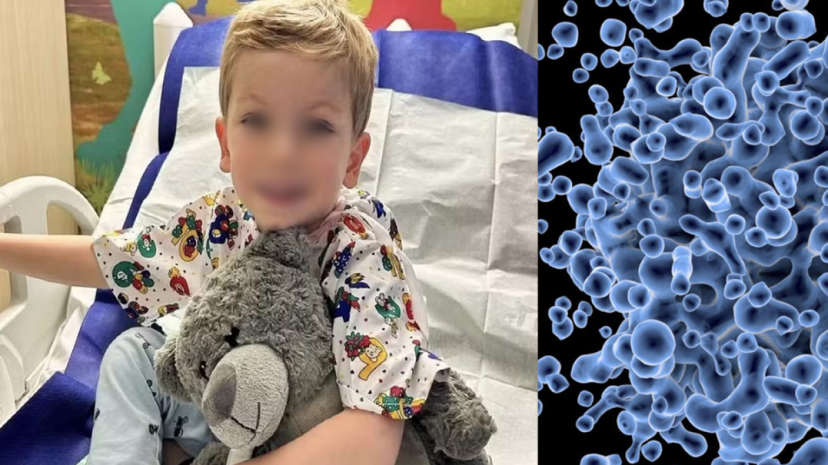 Mujer encontró un bulto en su hijo de 2 años y los médicos le dijeron que era benigno, pero tenía cáncer