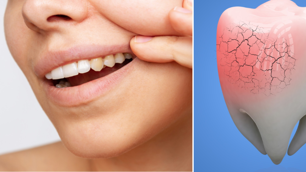Odontóloga enumera los nutrientes que hay que consumir para mantener el esmalte de los dientes fuerte y saludable