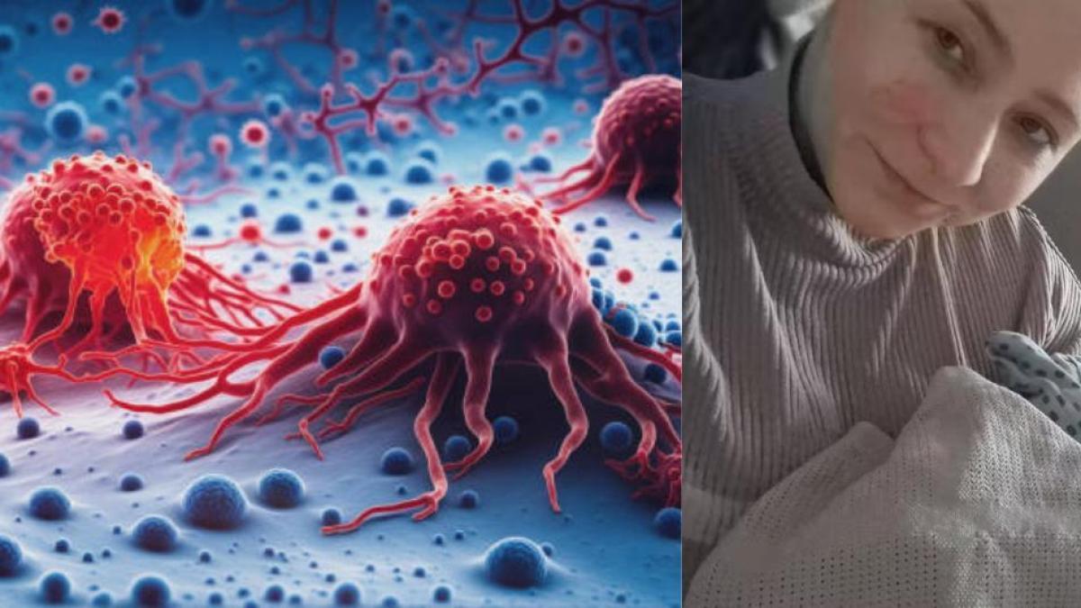 Los médicos pensaron que se le había desprendido la retina, pero en realidad tenía cáncer en el ojo