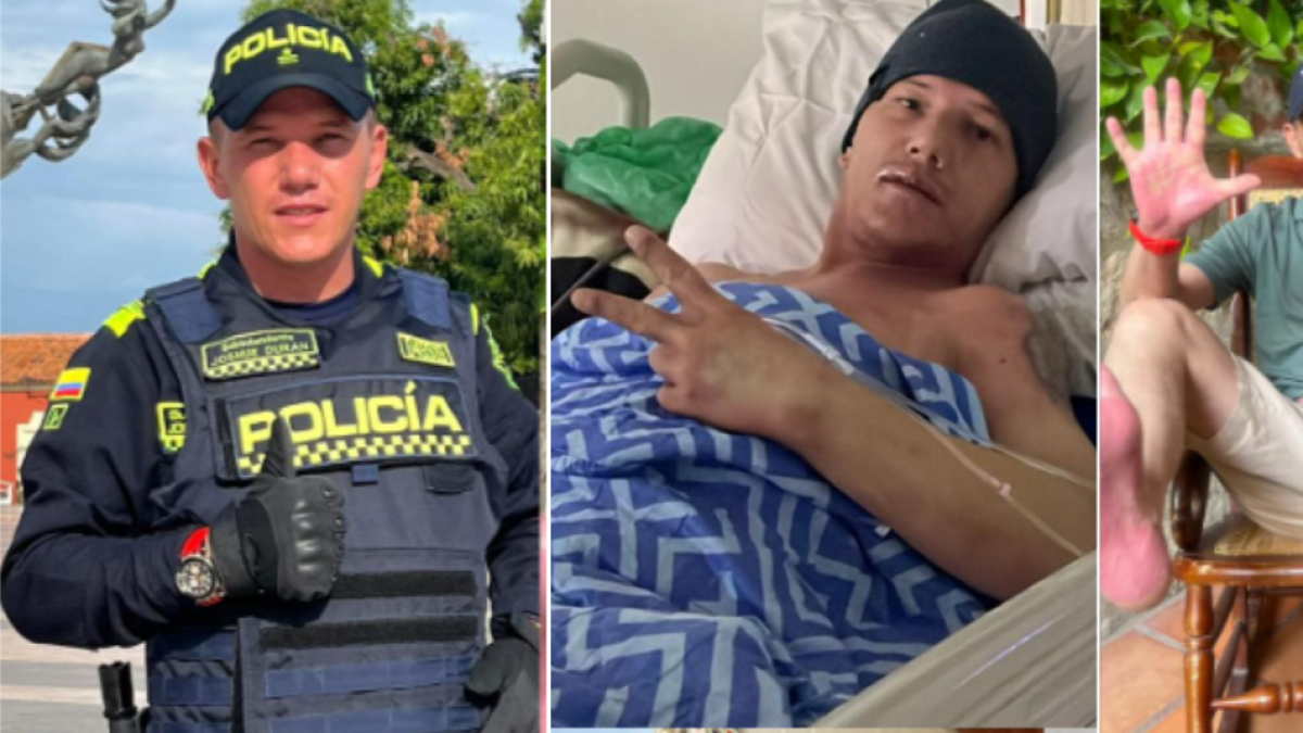 Kolombiya'daki en iyi polisin ICU'da ve nadir bir sendromla sona erdiği kendi kendini birleştirme: 'Öleceğimi düşündüm'