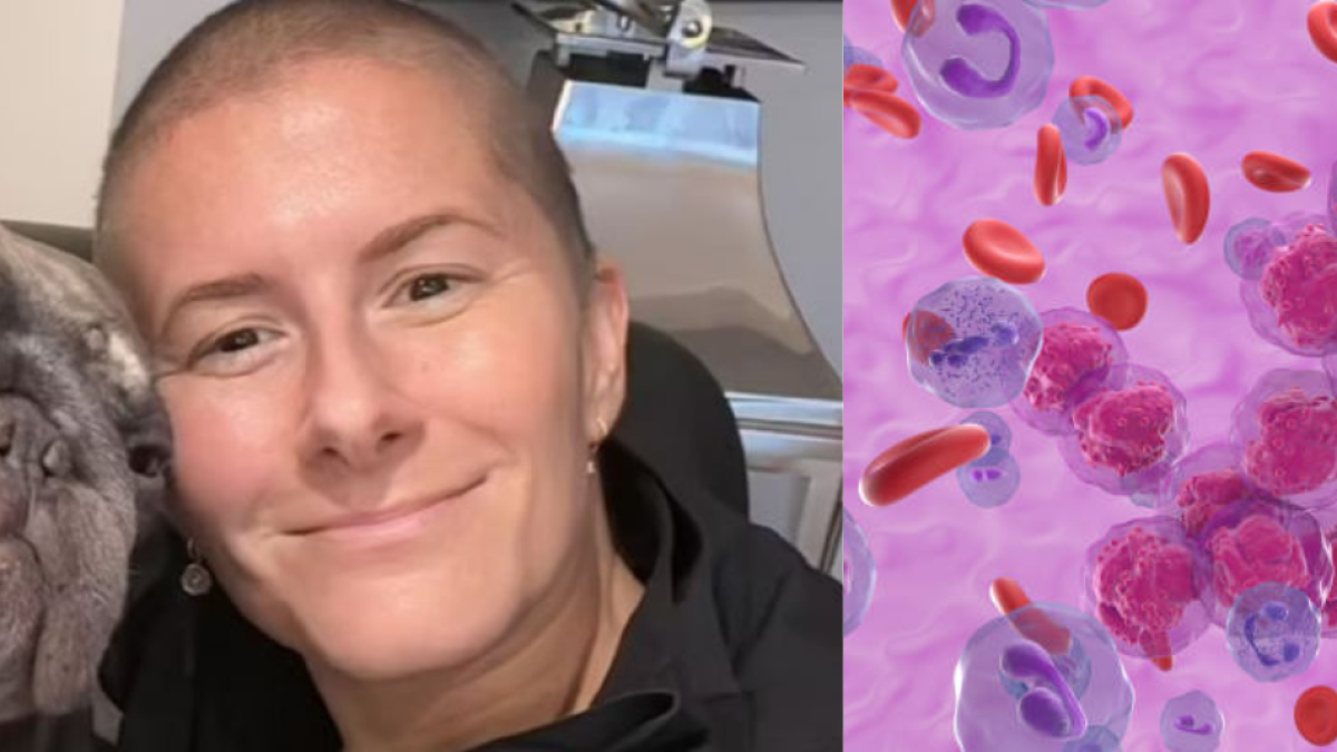 Atleta fue diagnosticada con un agresivo cáncer: los médicos pensaban que sus síntomas eran por covid prolongado