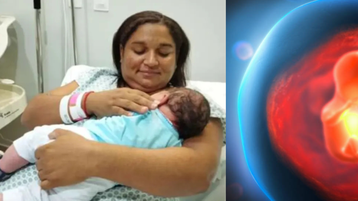 Un bebé de 5,1 kilos nació en Brasil: un caso de macrosomía fetal sin complicaciones médicas