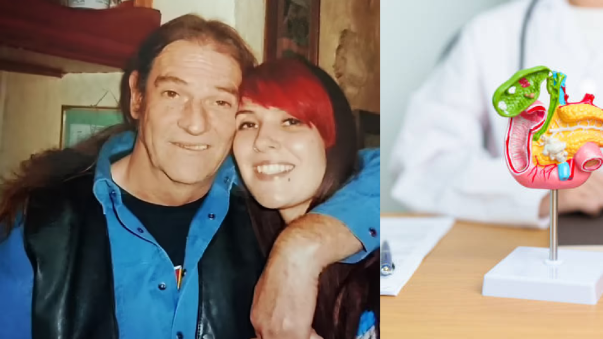 Hombre fue diagnosticado con cáncer de páncreas en etapa 4: los 2 síntomas que confundieron con una hernia