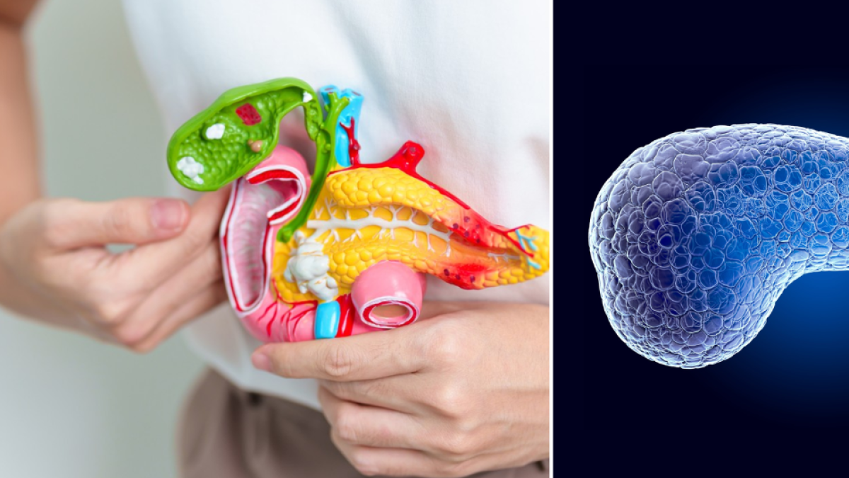 Científicos identifican una de las claves de la alta agresividad del cáncer de páncreas: está en una proteína
