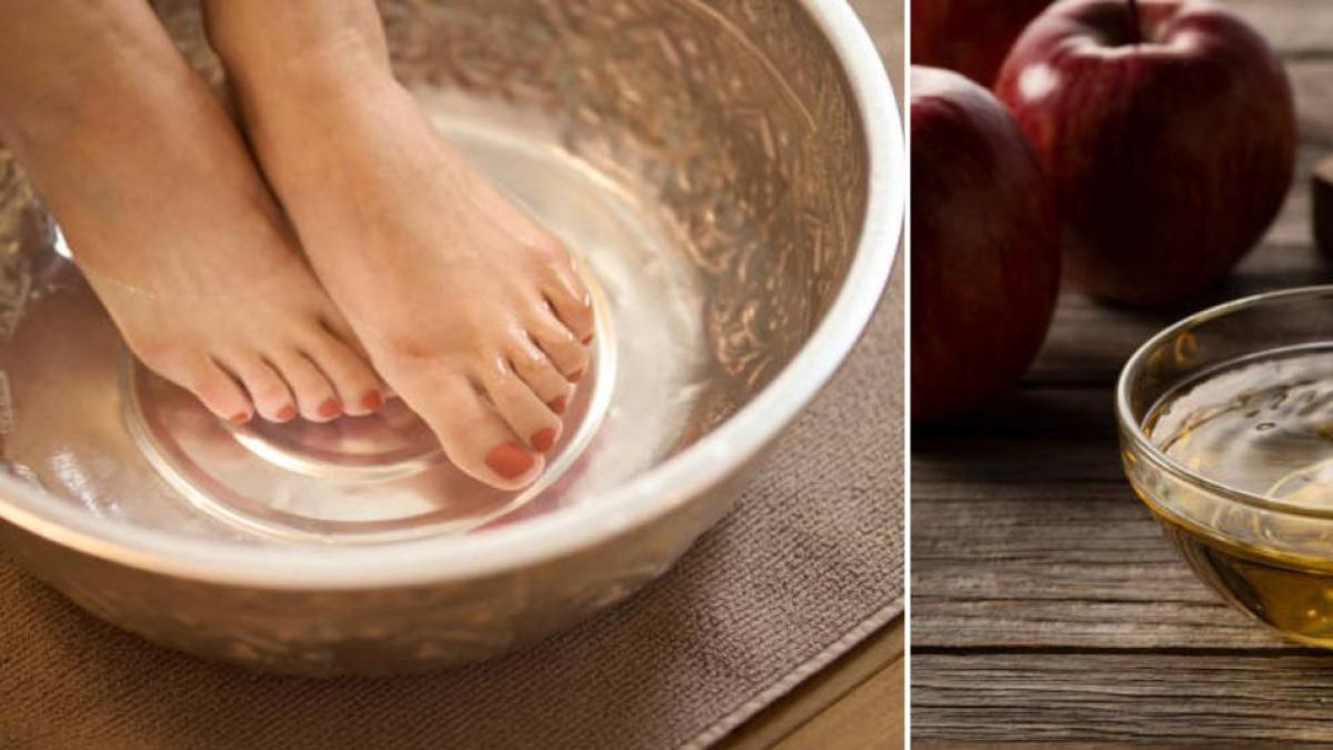 ¿Bañarse los pies con vinagre de manzana? Estos son los beneficios y la manera correcta de hacerlo