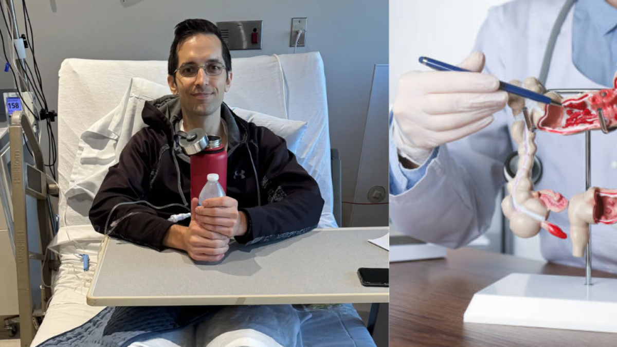 Hombre sano de 35 años fue diagnosticado con cáncer de colon en etapa 3: el síntoma que desearía no haber ignorado