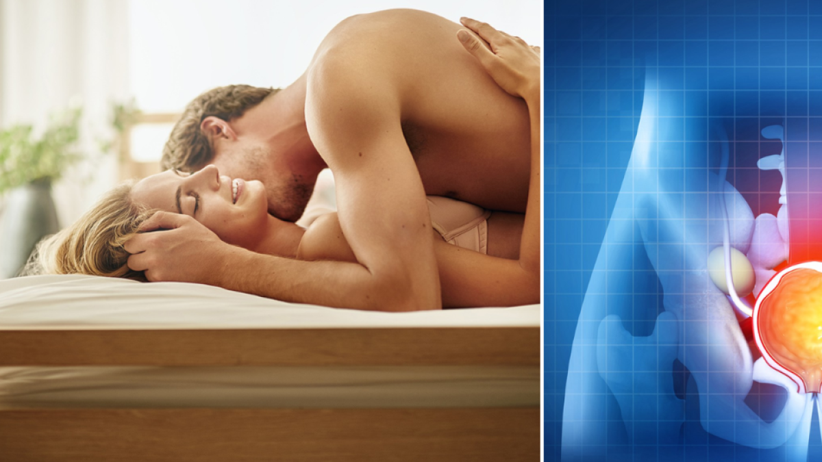 ¿Qué sucede con la próstata si no tiene relaciones sexuales? Esto dice la ciencia