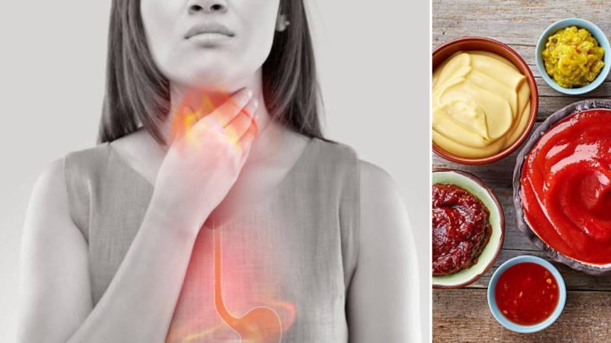 ¿Qué alimentos debe evitar si tiene reflujo?