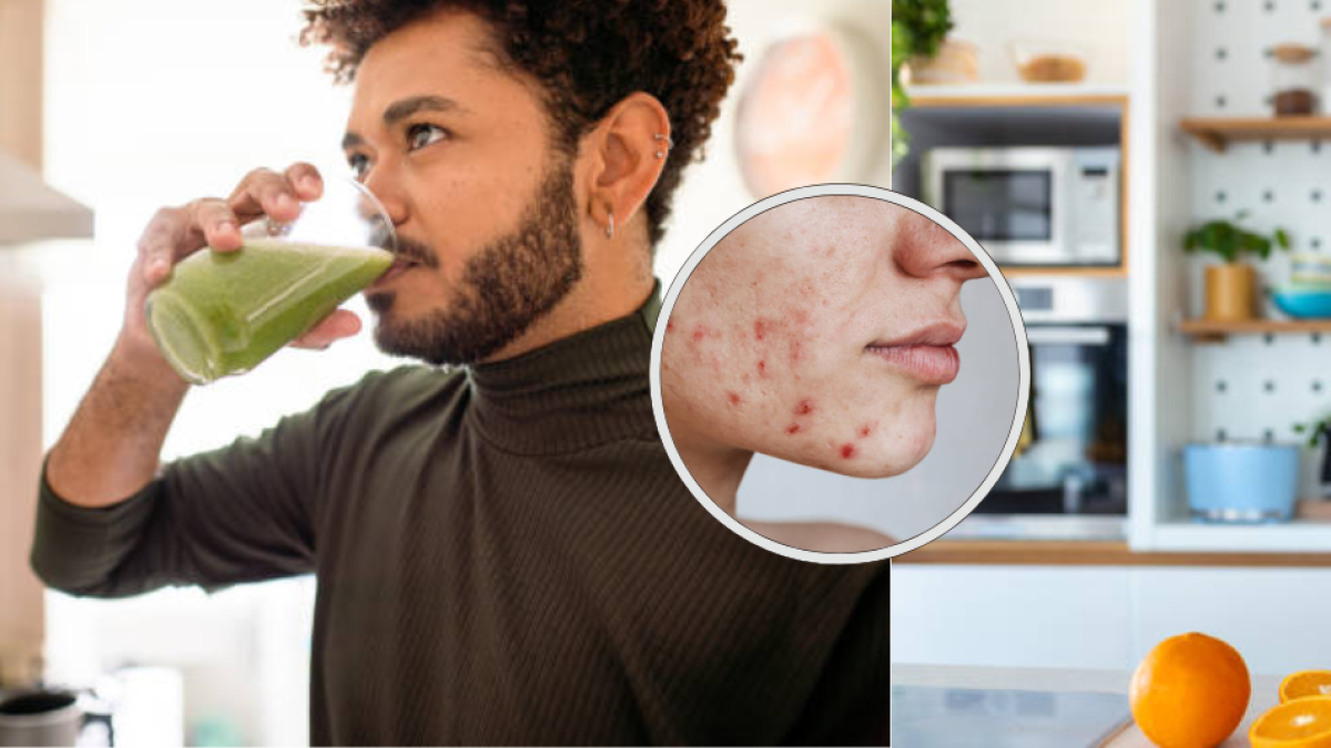 Las bebidas que quitan las manchas de la piel y reducen el acné de la cara: debe tomarlas con frecuencia