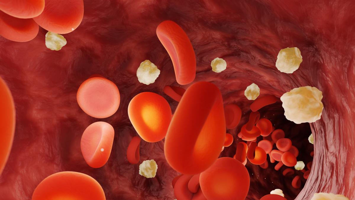 Estas son las seis razones por las que se le puede subir la glucosa y quizá no sabía: no solo por lo que come