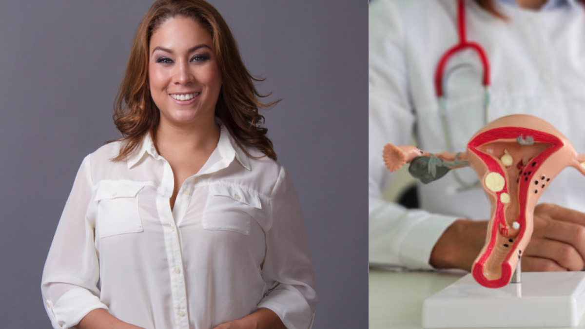 Muere la actriz mexicana Renata del Castillo: ¿cómo fue su lucha contra el cáncer cervicouterino?