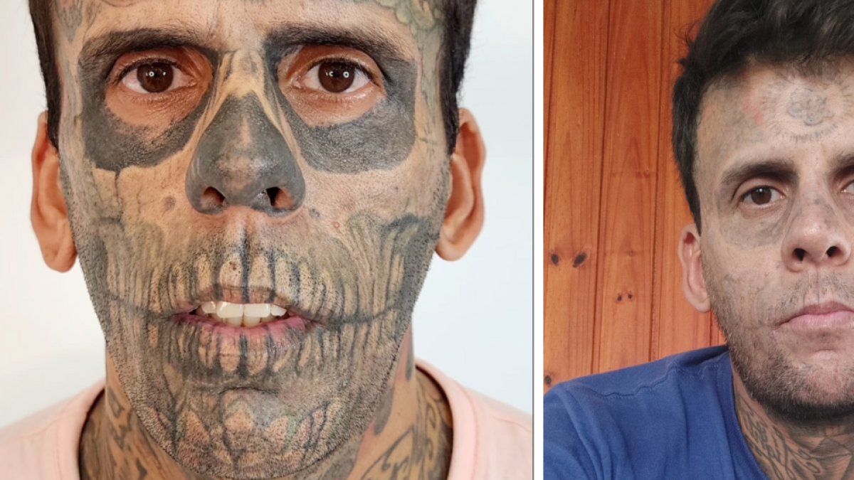 Leandro de Souza, el hombre más tatuado de Brasil, decidió quitarse los diseños: 'El dolor es horrible'