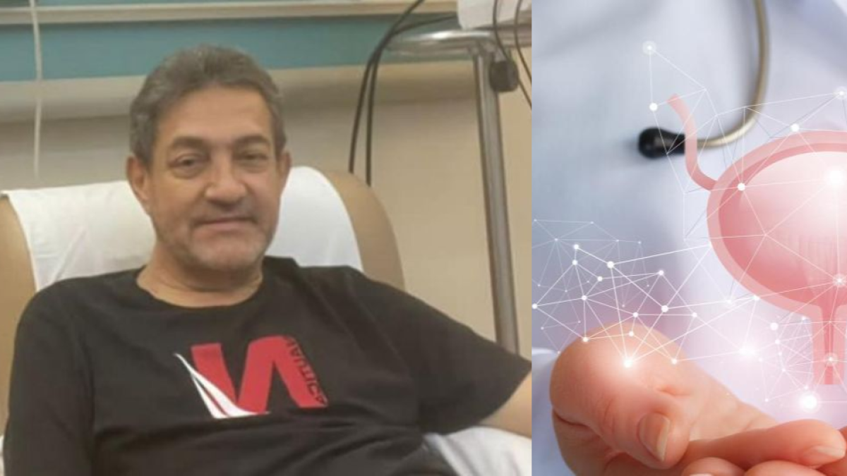 Hombre tenía problemas al orinar y le diagnosticaron cáncer de vejiga: oncólogo explica síntomas y cómo prevenir