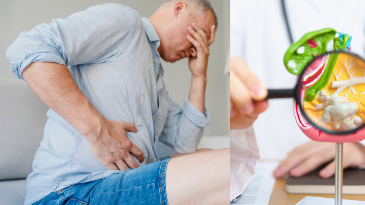 Oncólogo revela cuáles son las personas que tienen mayor riesgo de tener cáncer de páncreas