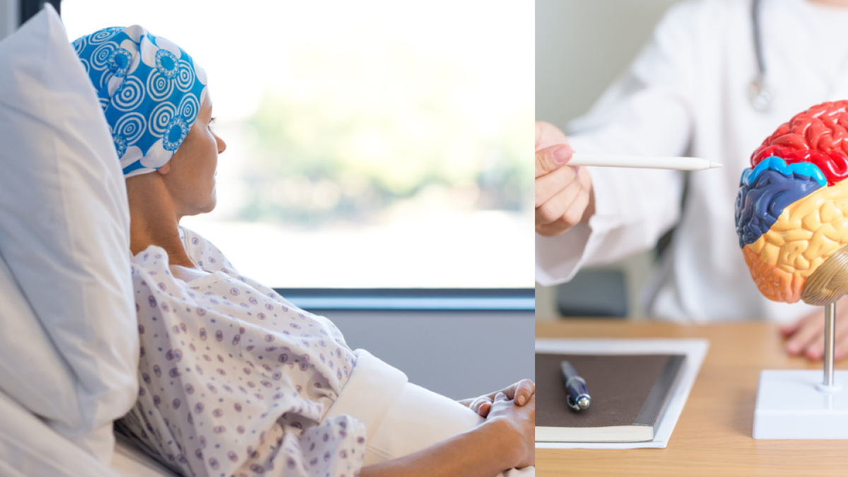Mujer en Reino Unido presentaba fuertes dolores de cabeza, pensó que era migraña y resultó ser cáncer cerebral