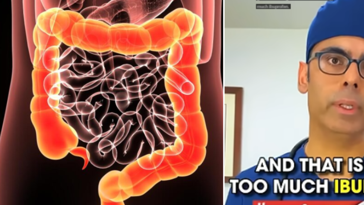 Gastroenterólogo revela cuál es el analgésico común que, en exceso, daña el intestino: ‘Jamás lo haría’