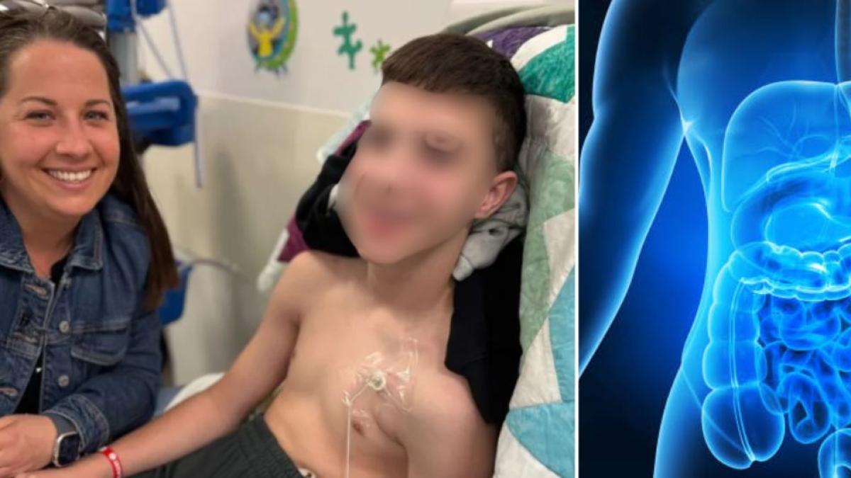 La extraña enfermedad digestiva que impide que este adolescente pueda comer: 'Nunca habíamos visto un caso así'