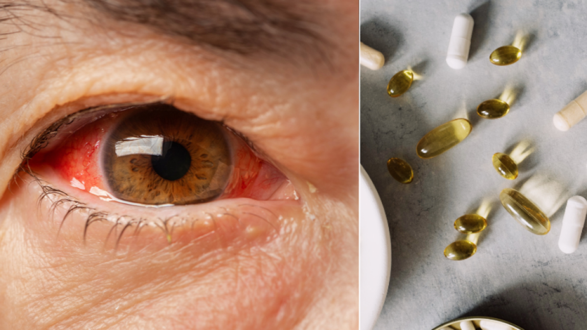 Ni láser ni gotas: un 'cóctel de vitaminas' podría ser la clave para frenar el glaucoma