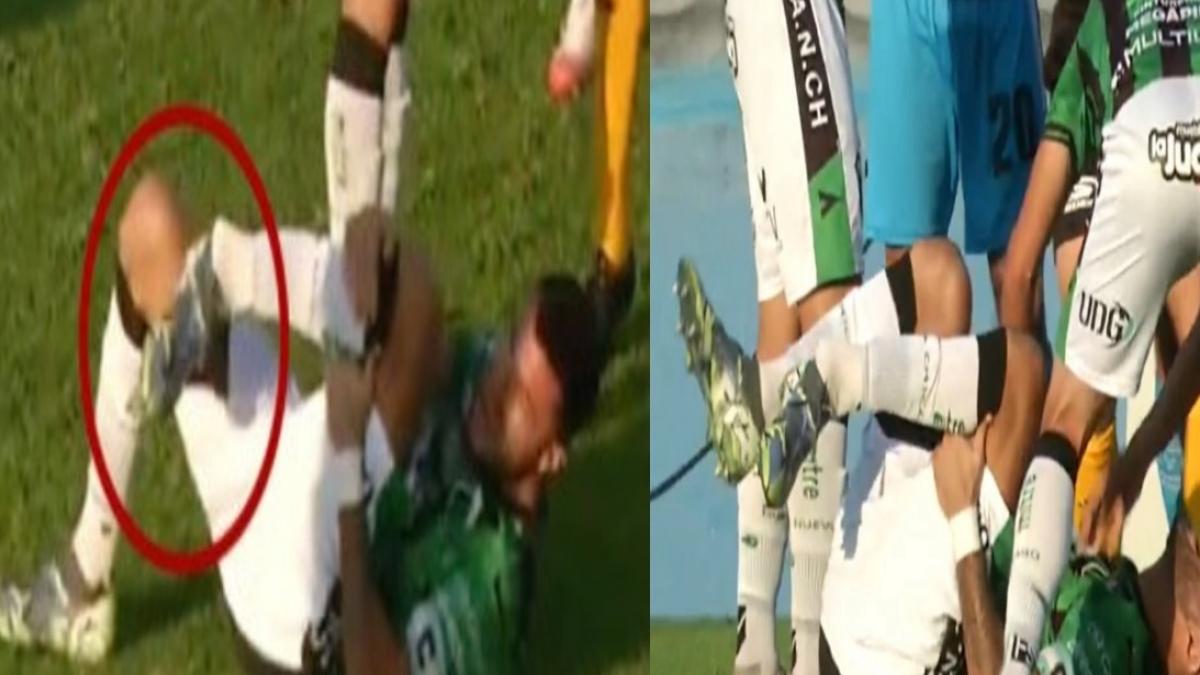 Video | Escalofriante lesión de Stefano Callegar, capitán de Nueva Chicago en Argentina: imágenes sensibles