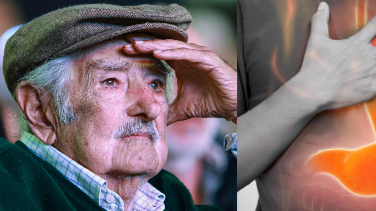 Murió José 'Pepe' Mujica ¿Cuál es el tipo de cáncer que padeció el expresidente de Uruguay?