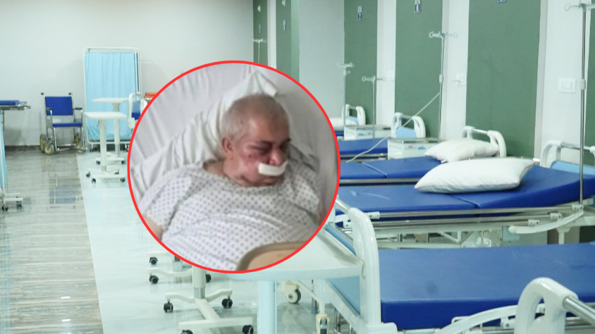 Conserje de 70 años recibió brutal golpiza por parte de residente de un edificio en Chile: podría perder el ojo