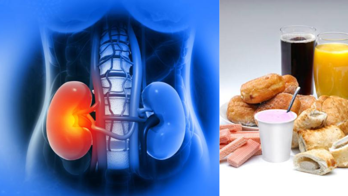 ¡Cuidado con lo que Comes! 7 Alimentos que Pueden Dañar tus Riñones (y Cómo Disfrutarlos sin Riesgos)