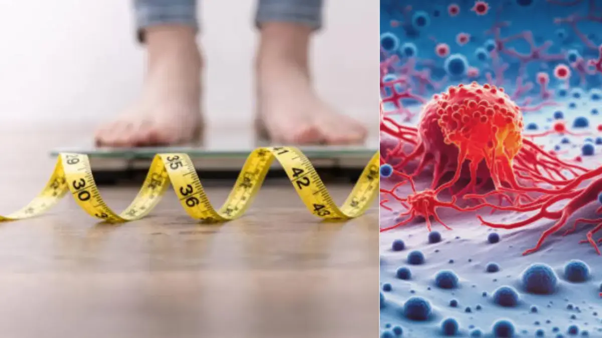 ¡Noticias Impactantes! Perder Peso Reduce el Riesgo de Hasta 13 Tipos de Cáncer, Revelan Estudios