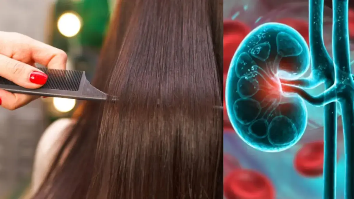 Mujer sufrió una falla renal tras aplicarse queratina brasileña en el cabello: ‘A los 27 años, tengo los riñones de una persona de 80’