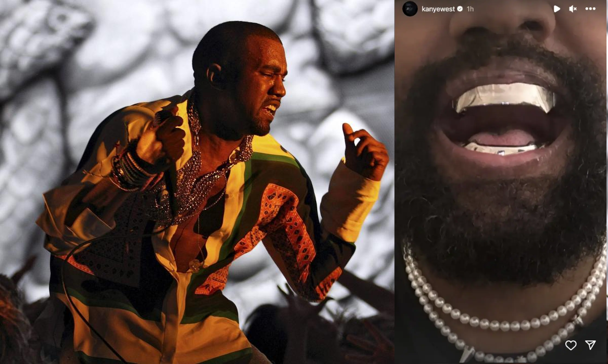 Kanye West Se Implanta Dentadura De Titanio Inspirada En Tiburón Cuánto Gastó 8639