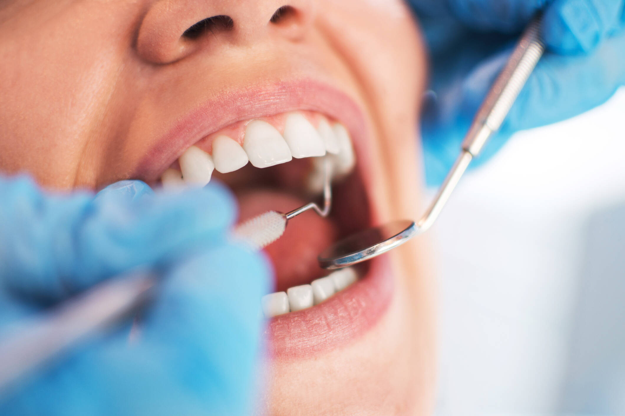 La buena higiene bucal aumenta la probabilidad de conservar los dientes durante toda su vida.
