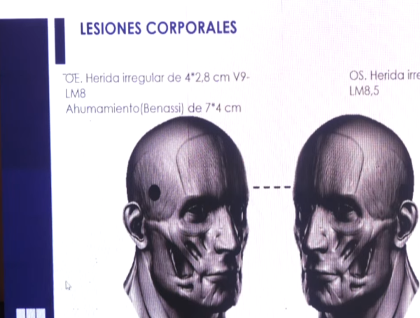 El arma usada estaba a contacto con la cabeza.