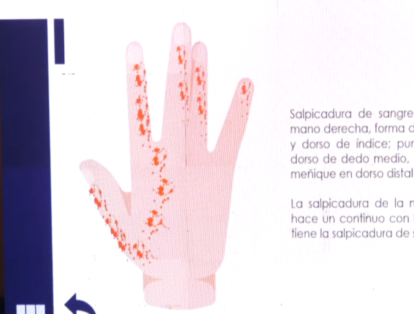 Había rastros de pólvora en el cráneo y la mano.