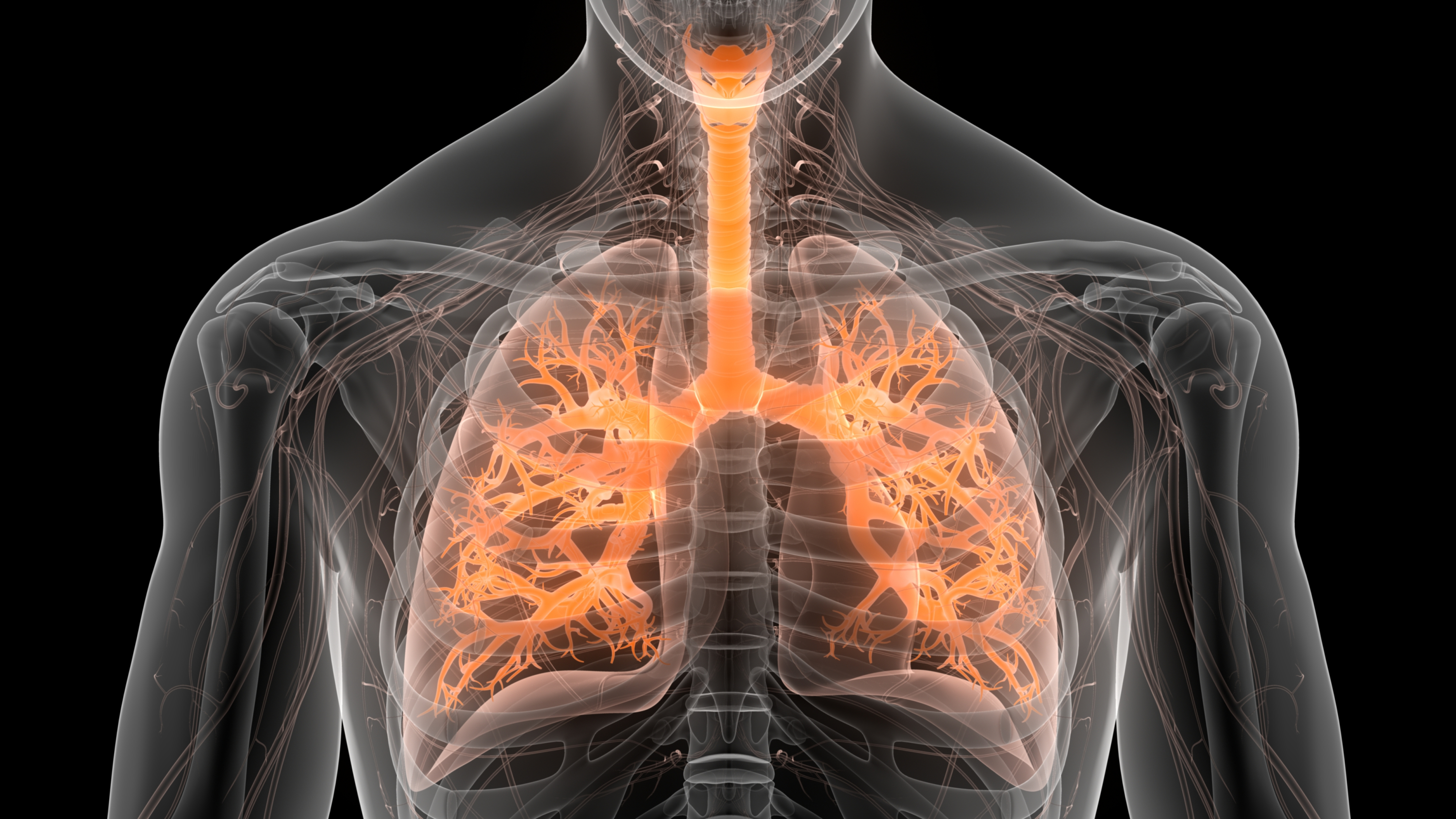 La fibrosis pulmonar es una enfermedad en la que el tejido de los pulmones se cicatriza e impide la respiración.
