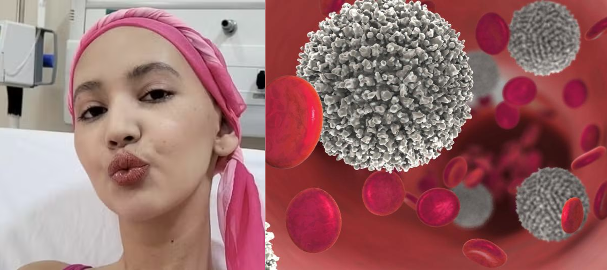 cáncer