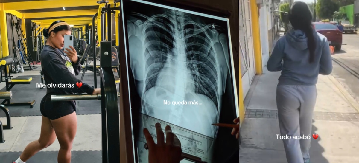 Il a subi une blessure à la colonne vertébrale