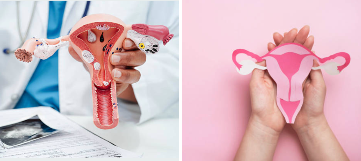 cancro uterino
