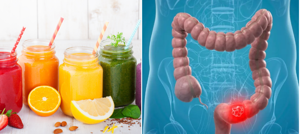 Jugos y colon